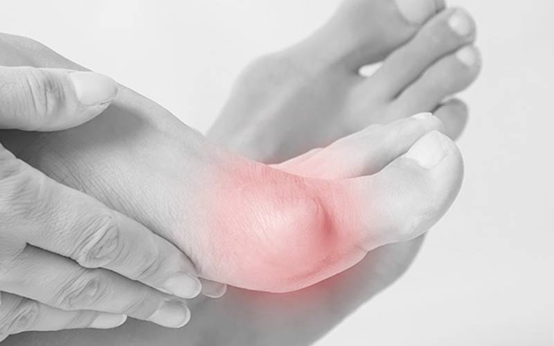 Hallux valgus: Vorbeugen und Pflegen