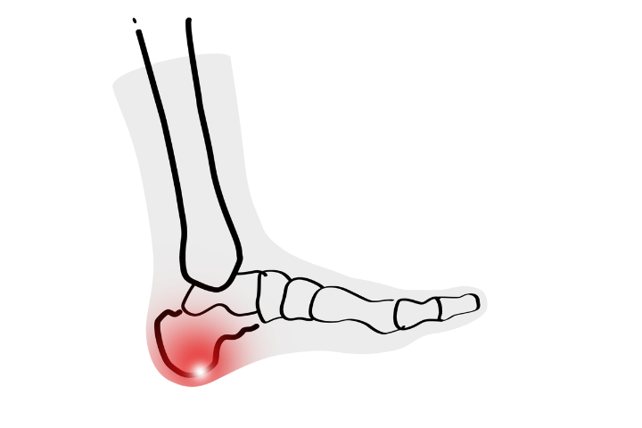 Wo INFINIRI Komfortsocken ins Spiel kommen